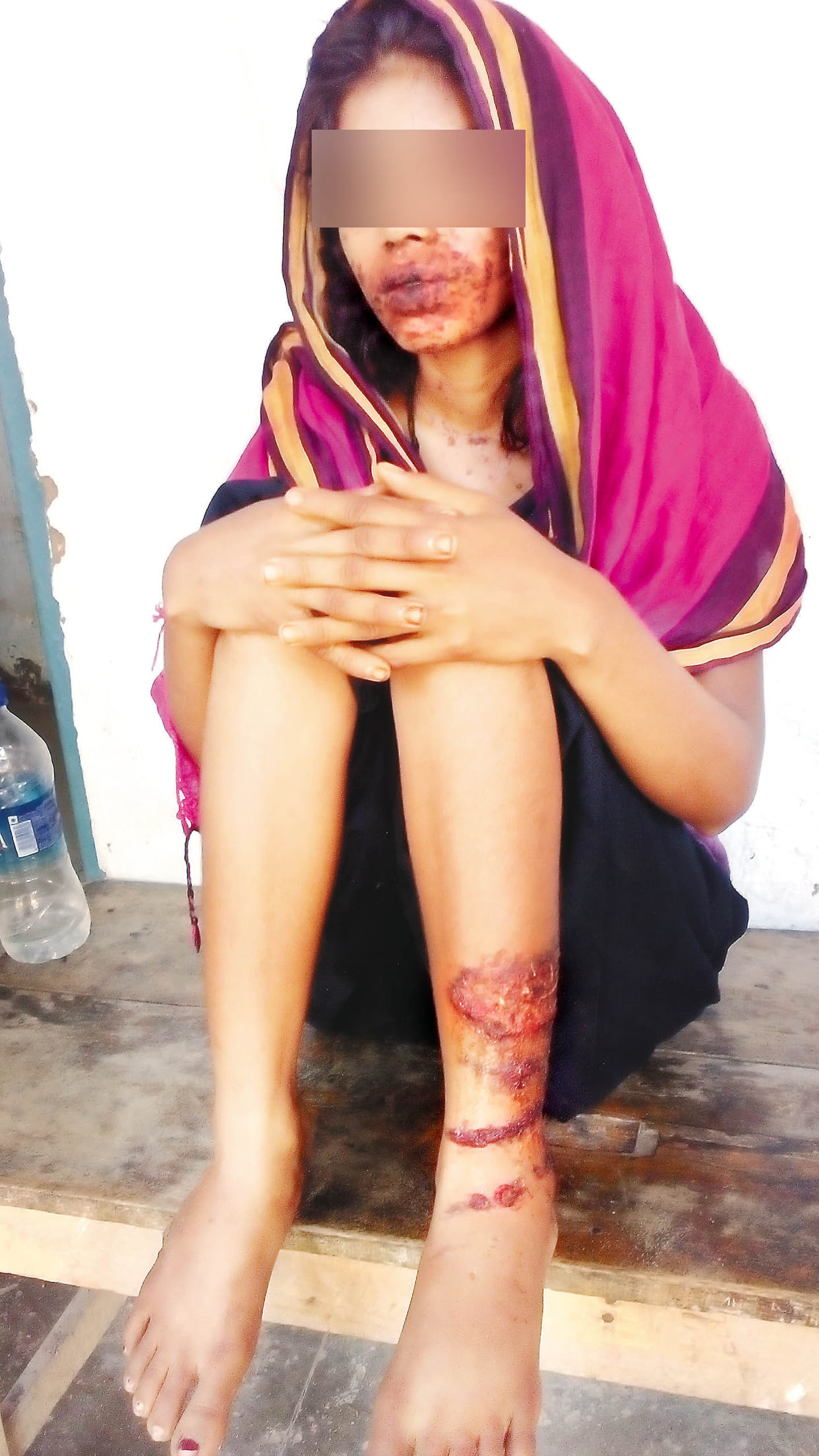 occultist burned girls body
