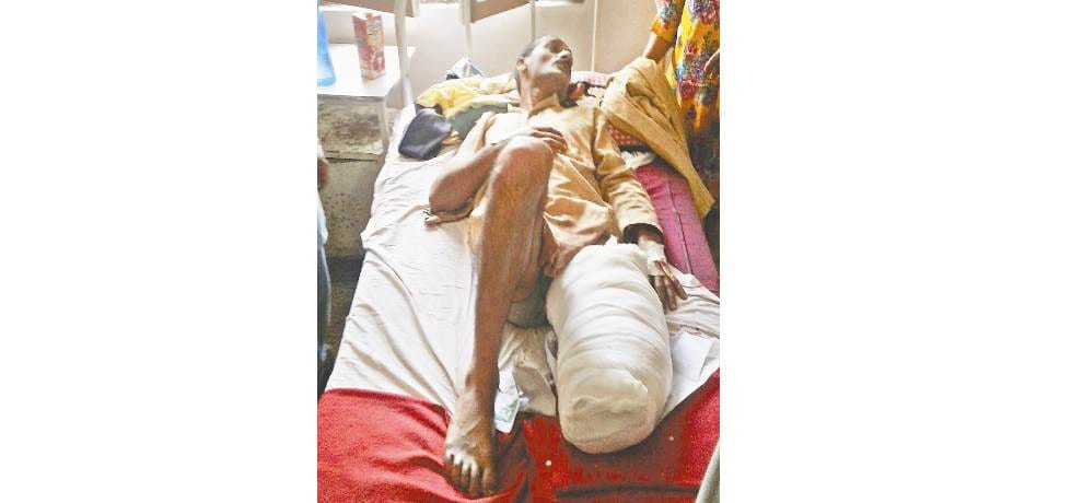 Doctor remove leg of chuni lal who was severely injured in monkeys attack