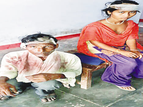 Beaten by drunken father and daughter