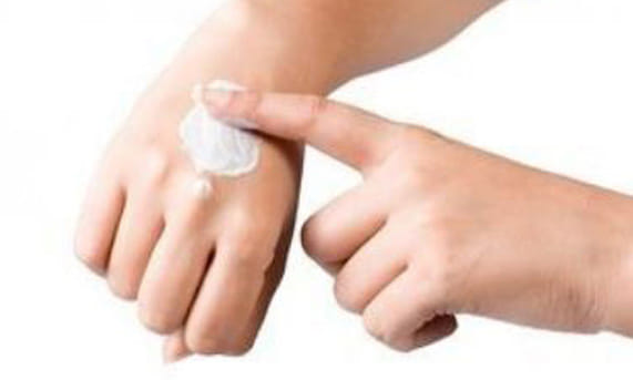 home remedies for burn