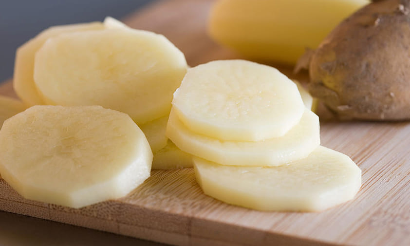 home remedies for burn