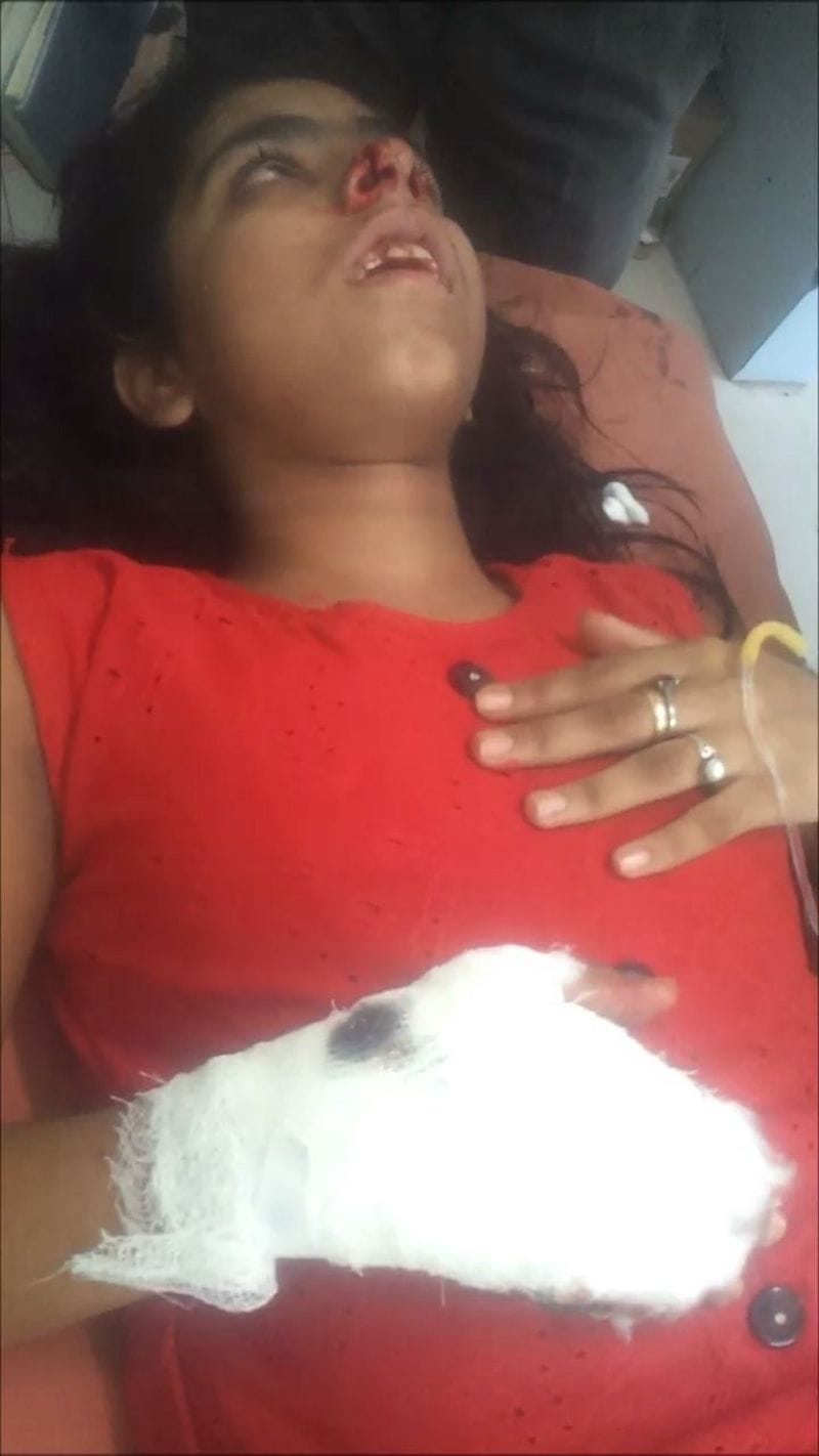 girl injoured by gun shot