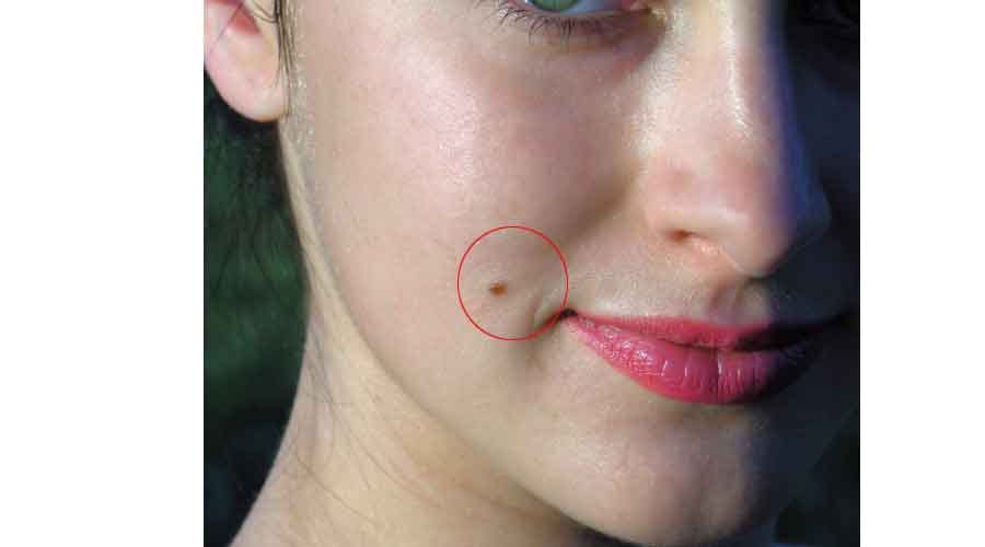 mole on these body parts are lucky