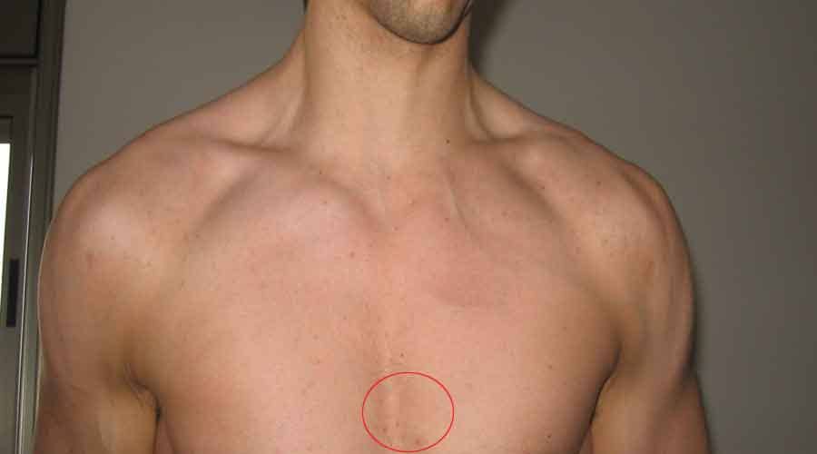 mole importance and significance on body