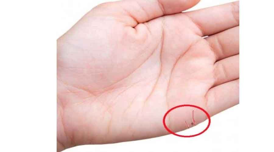 mole on these body parts are lucky
