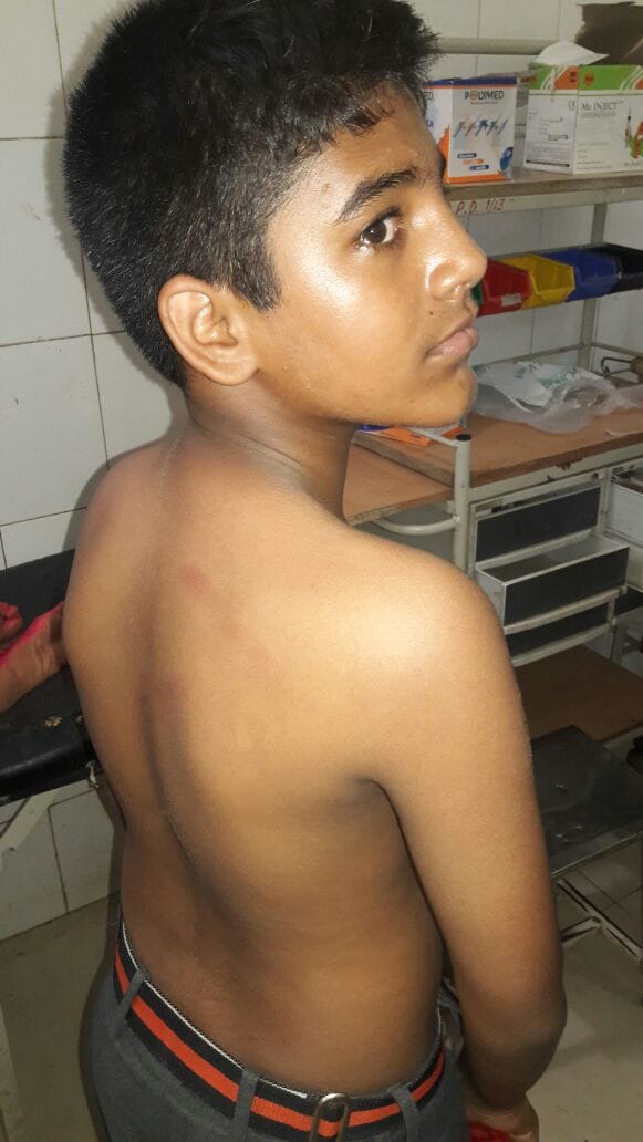 Student beaten by teacher in sitapur