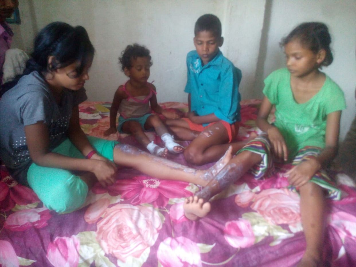  poured boiling oil on childrens are asleep