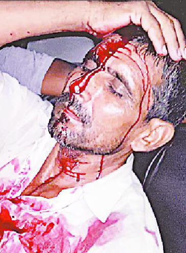 Many injured in clash