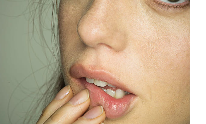 home remedy for pimples