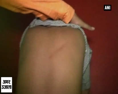 Teen thrashed by teacher for snapping plant stem