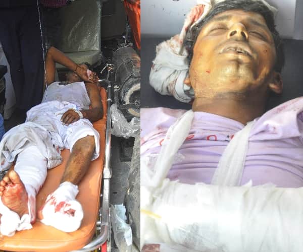 tractor trolly accident in lucknow many injured