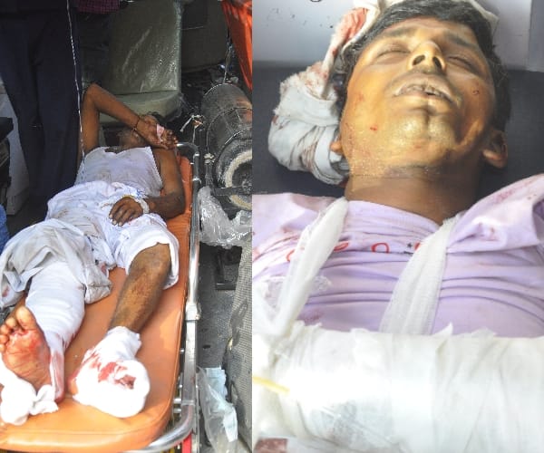 tractor trolly accident in lucknow many injured