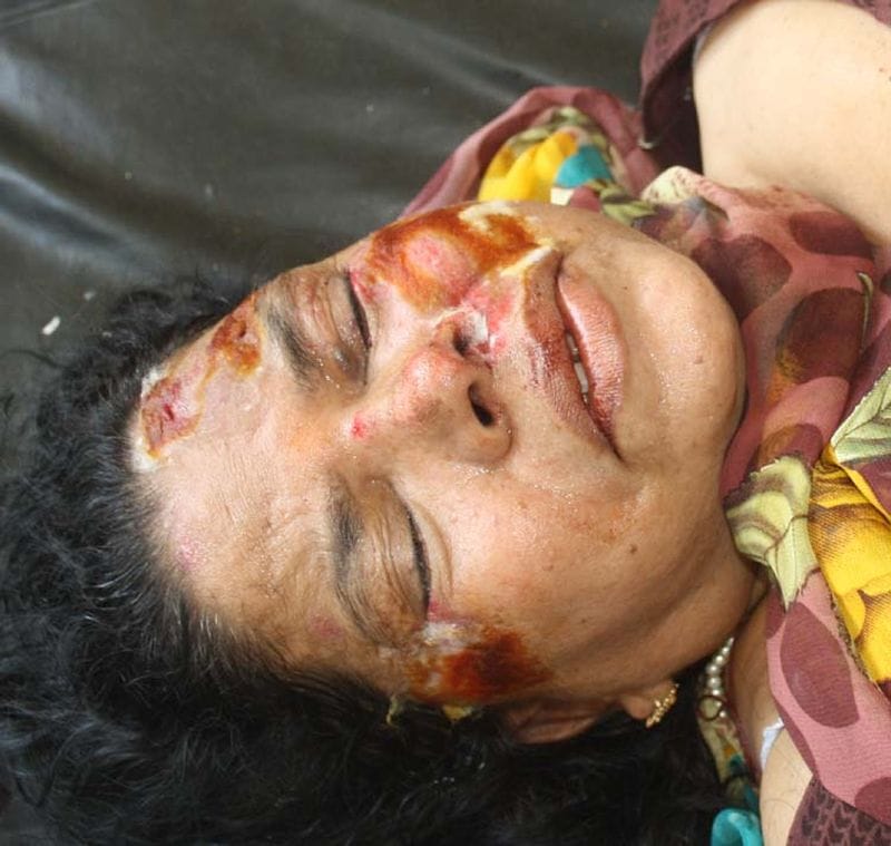 mother and son injoured in accident