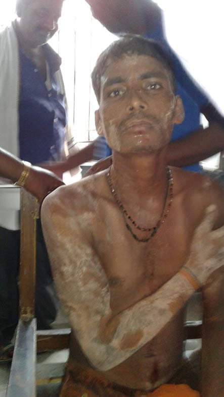 Injured three workers buried in debris