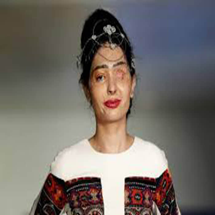 acid attack victim Reshma on ramp