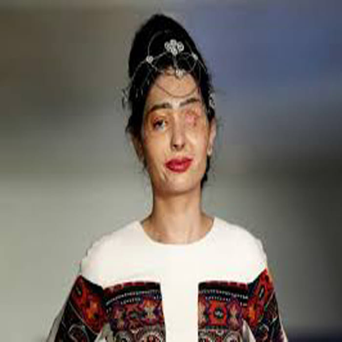 acid attack victim Reshma on ramp