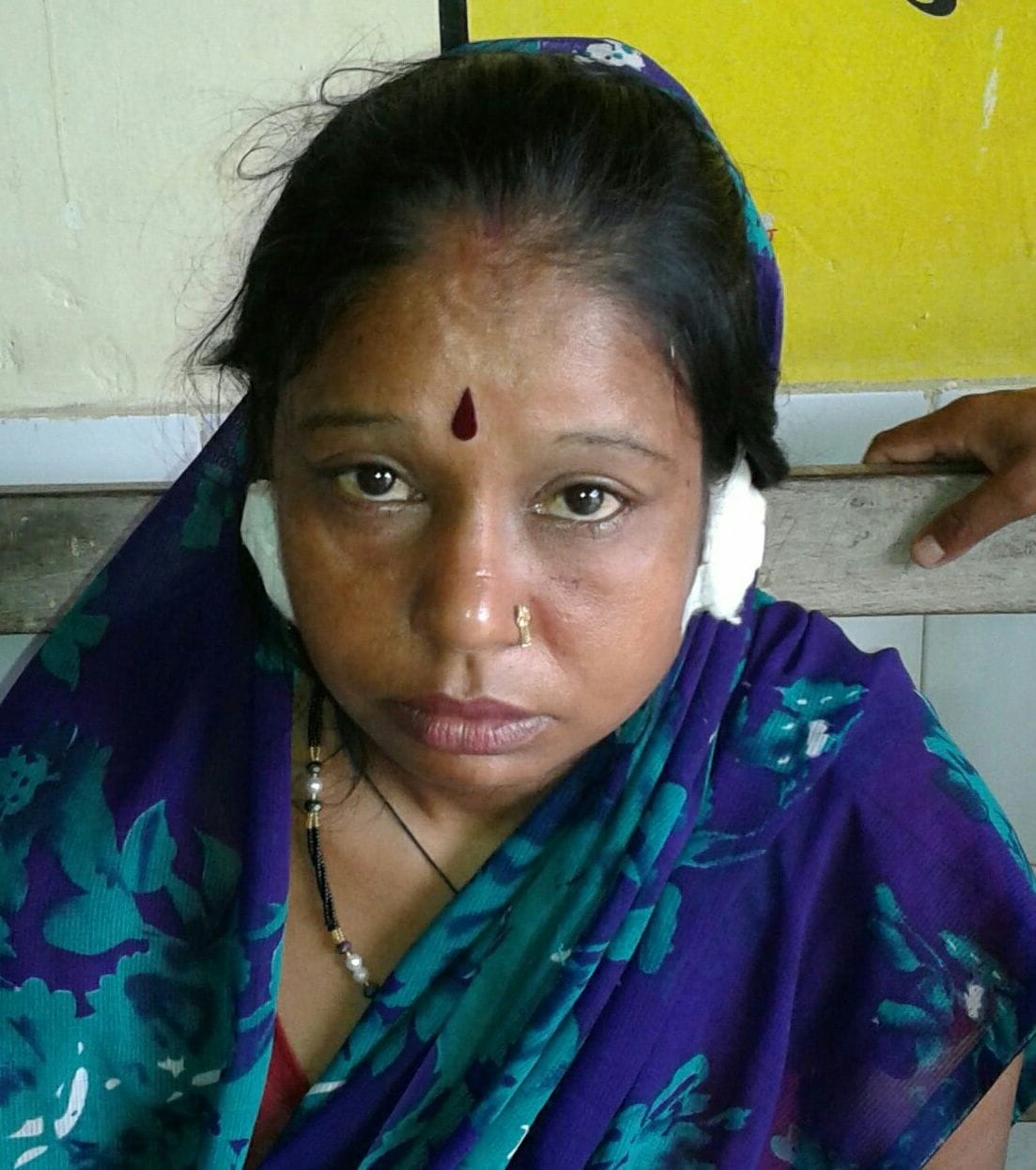 Bali and snatched the woman's ear shoplifter fled