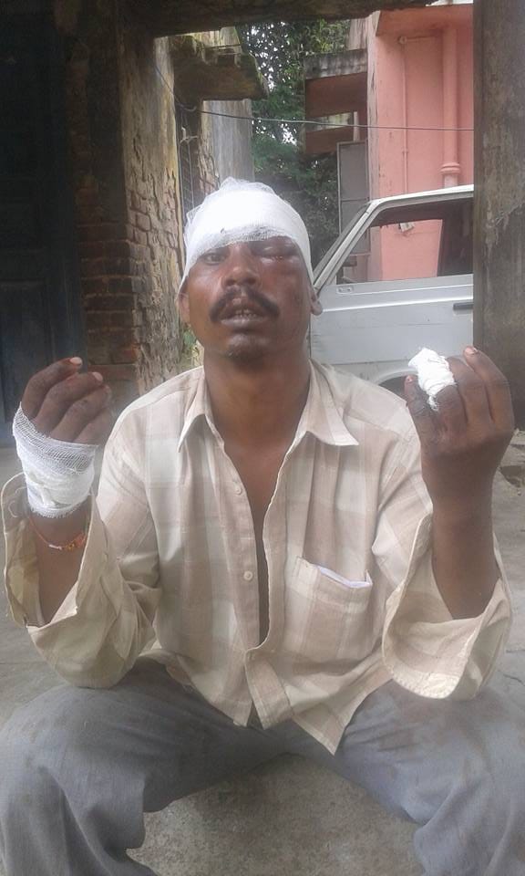 Land dispute father, brother attacked
