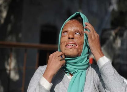  acid attacks in Uttar Pradesh.