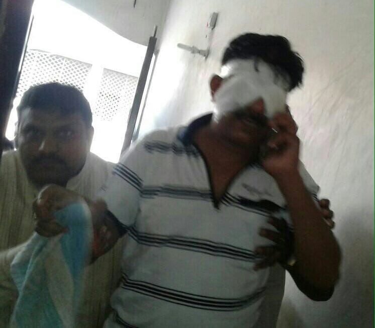 three youth threw red chilli powder in eyes of BJP MLA Kapildev Aggarwal
