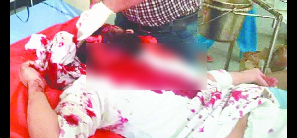 monkey attacks on sleeping man, injured badly and hospitalized 