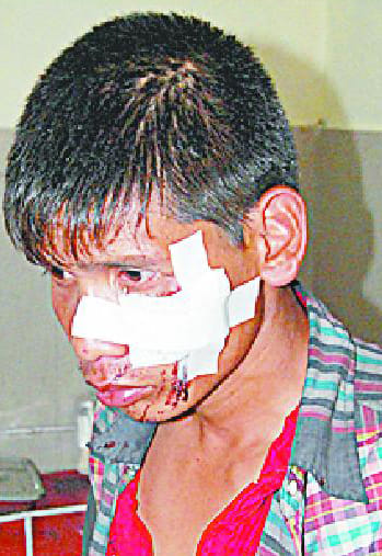 Many Nepalese tourists injured in crash