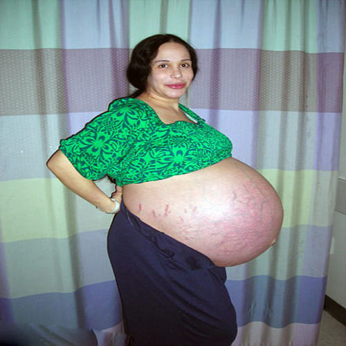 Controversial mother of 14 children Natalie Suleman 