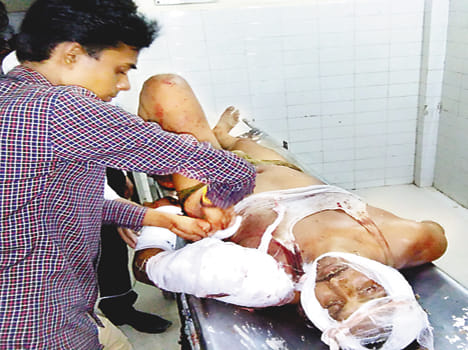 The bomb attack on villagers crazy bullet-Twine