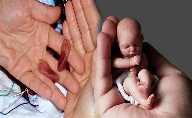 world's tiniest baby Emilia