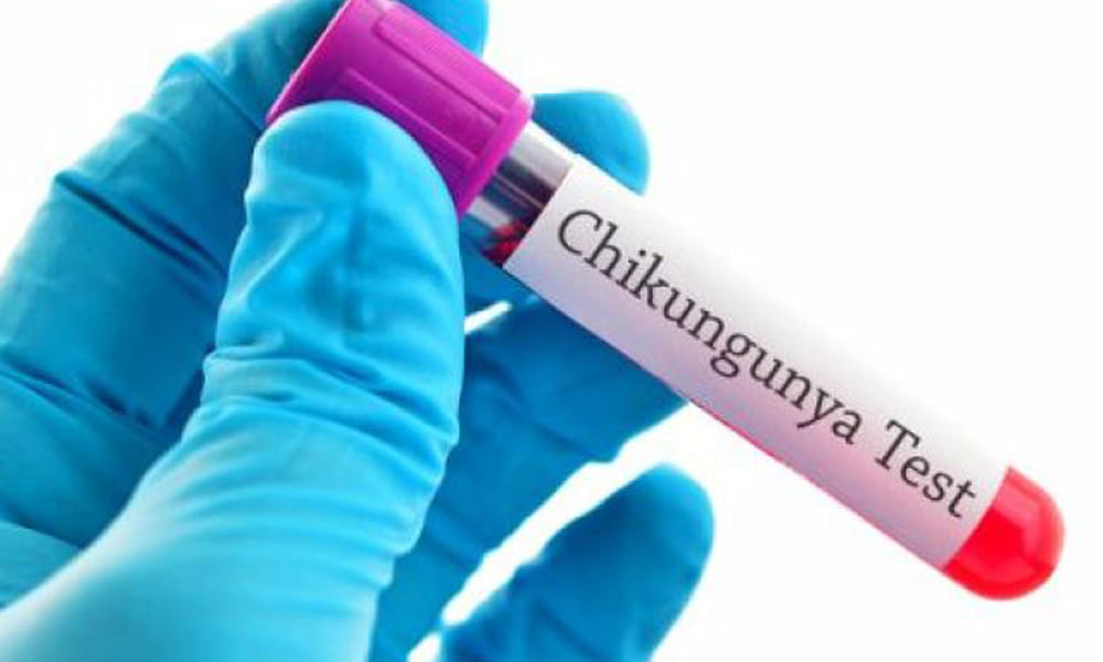 what is chickengunia and its origin?