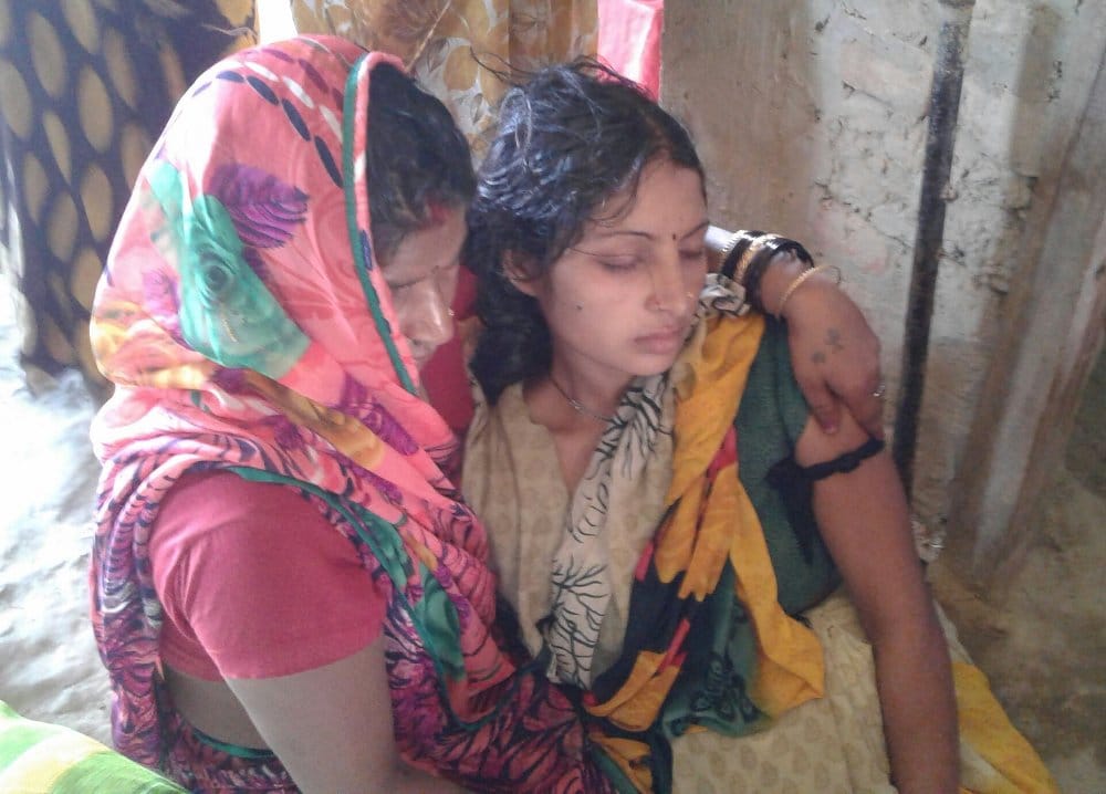 burnt lady dead in medical college