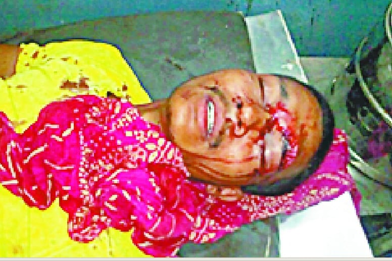 The two sides clash, several injured