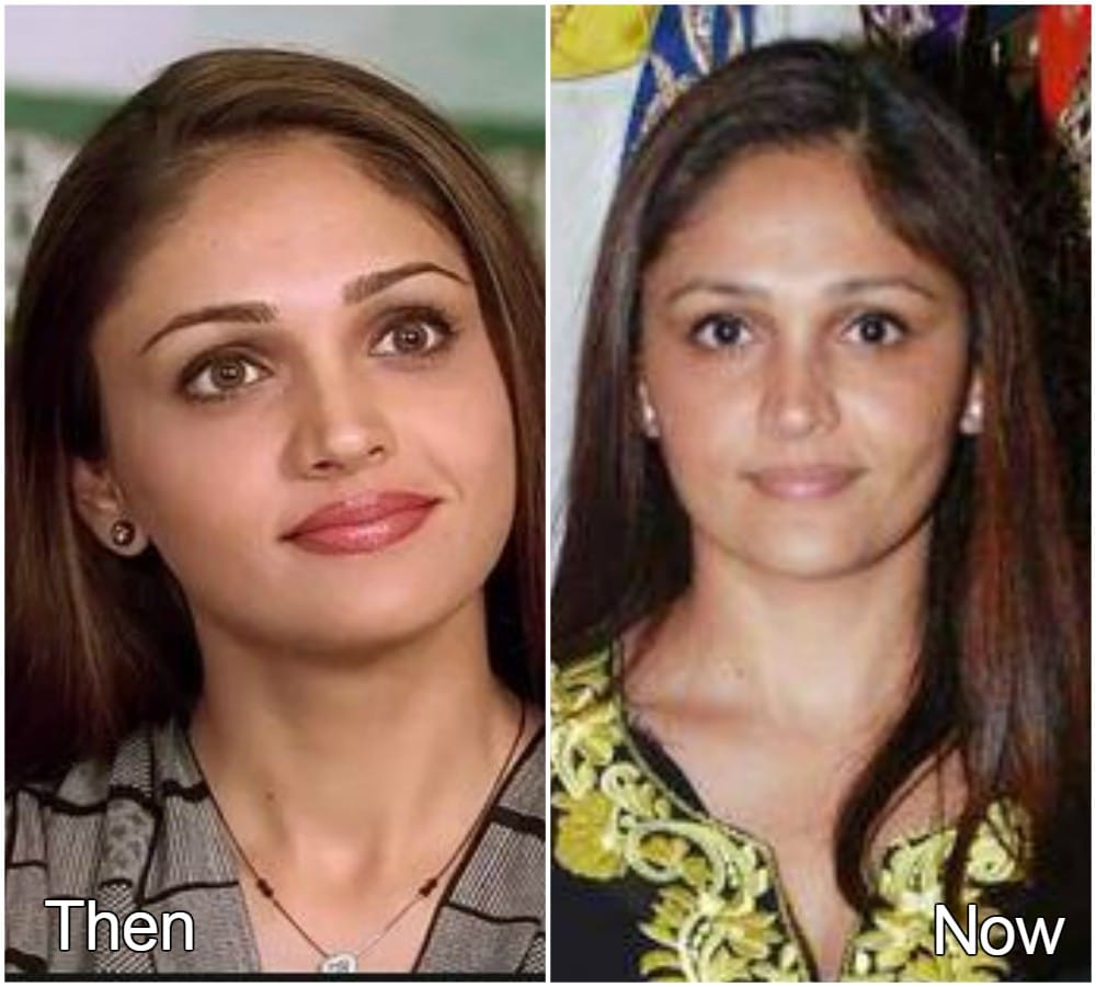 Tum bin starcast then and now 