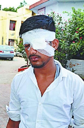 Teacher beating student's eye injury