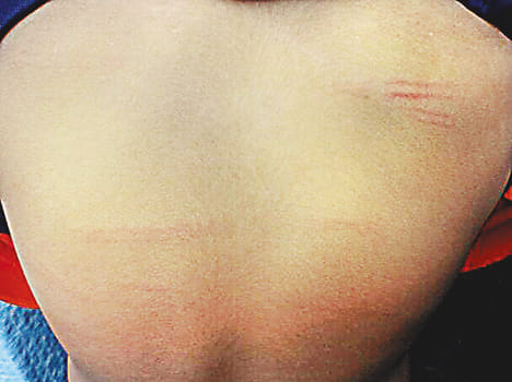 Student teacher beaten