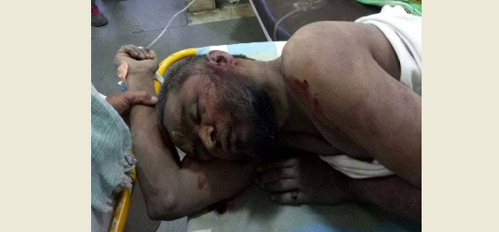two persons carrying waste of qurbani day were brutally beaten in doubt of beef in delhi