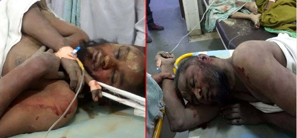two persons carrying waste of qurbani day were brutally beaten in doubt of beef in delhi