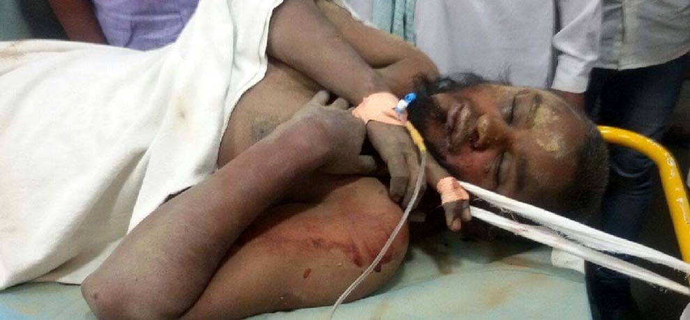 two persons carrying waste of qurbani day were brutally beaten in doubt of beef in delhi