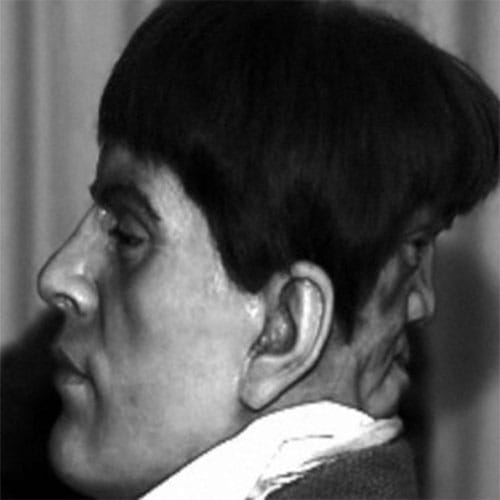 The Disturbing True Story of Edward Mordrake