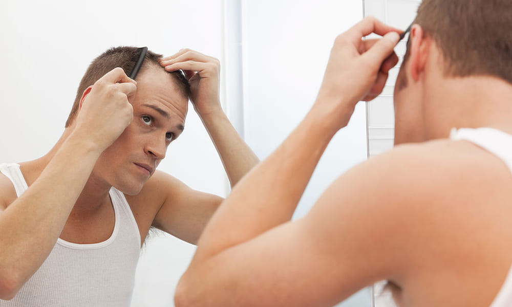 home remedies foe baldness