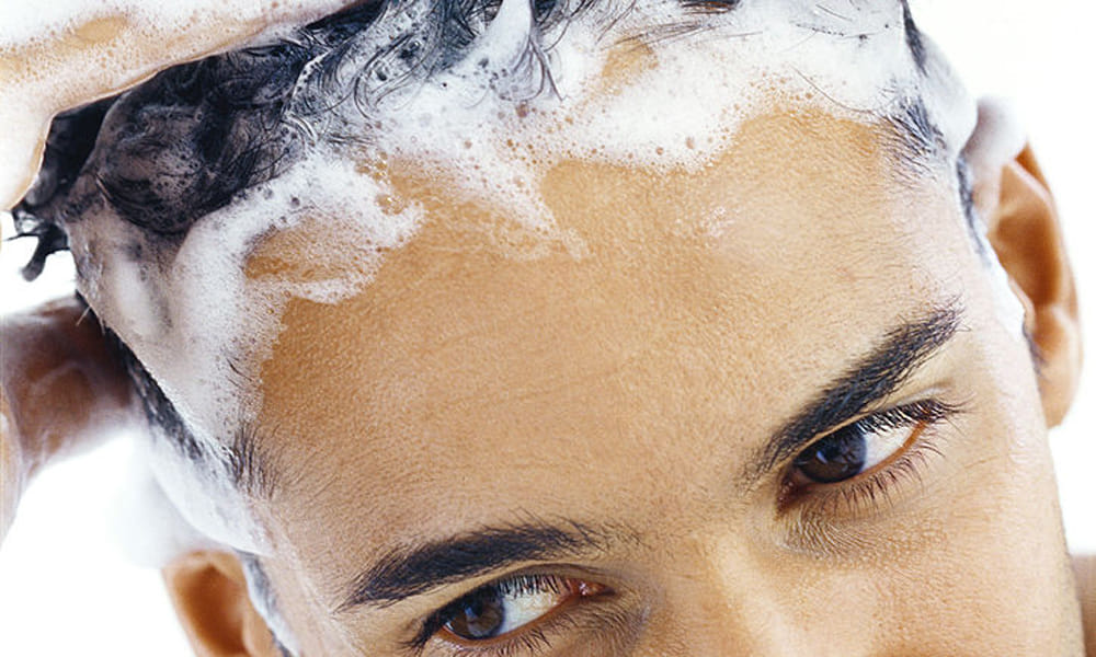 home remedies foe baldness