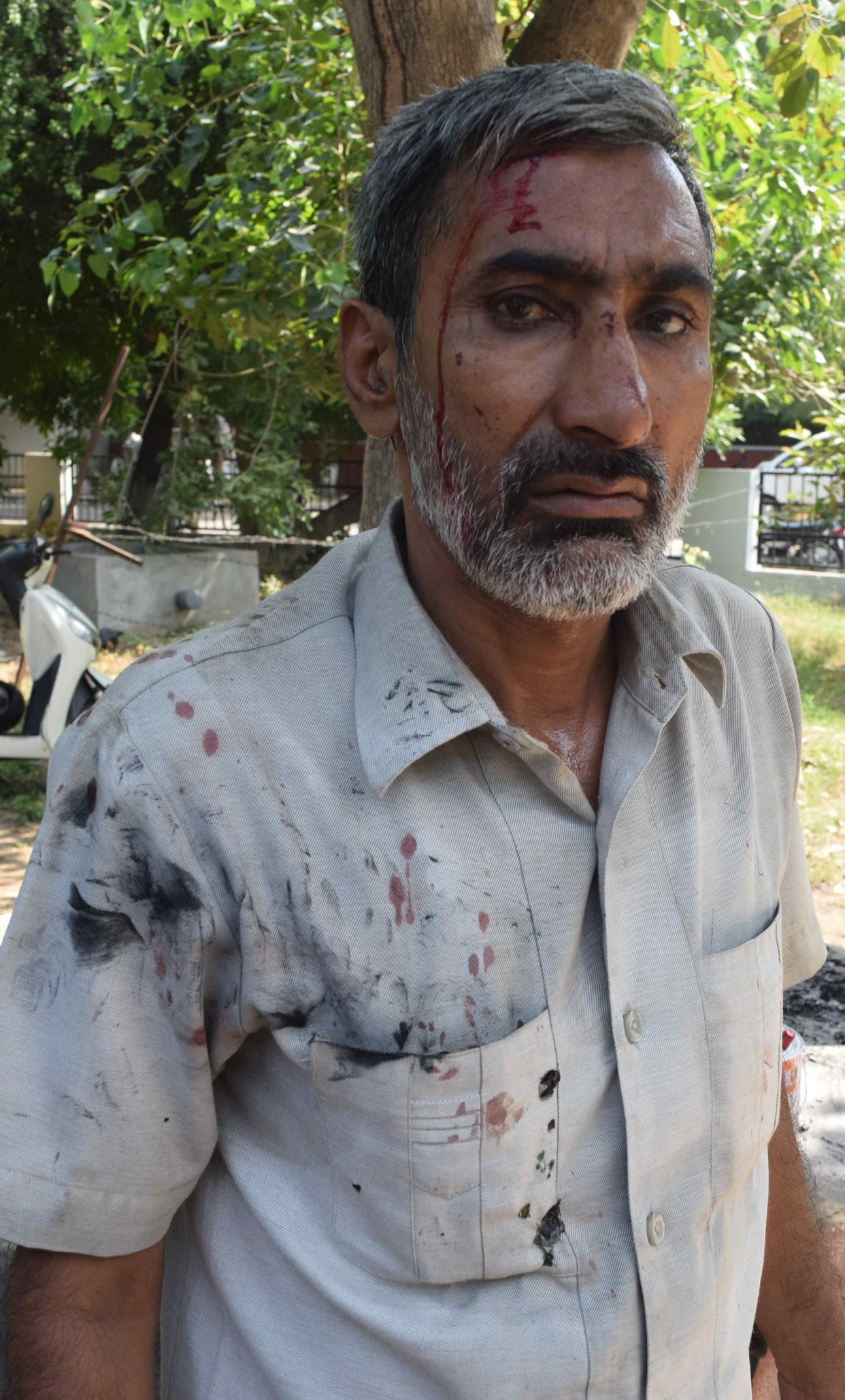 roadways worker attack on each other, police taken charge, 10 injured
