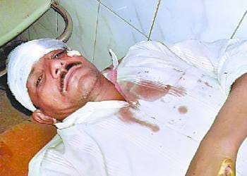 Eight injured in road accidents, serious