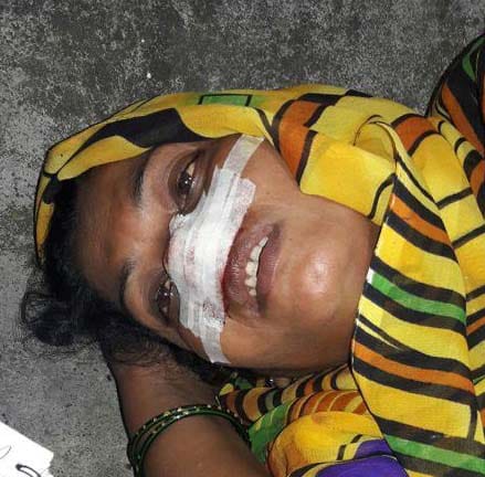 Brother of the widow reaped Nose, fled home closed 