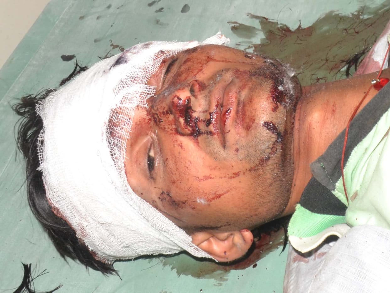 Tractor-trolley bus collision killed by a death, 14 injured