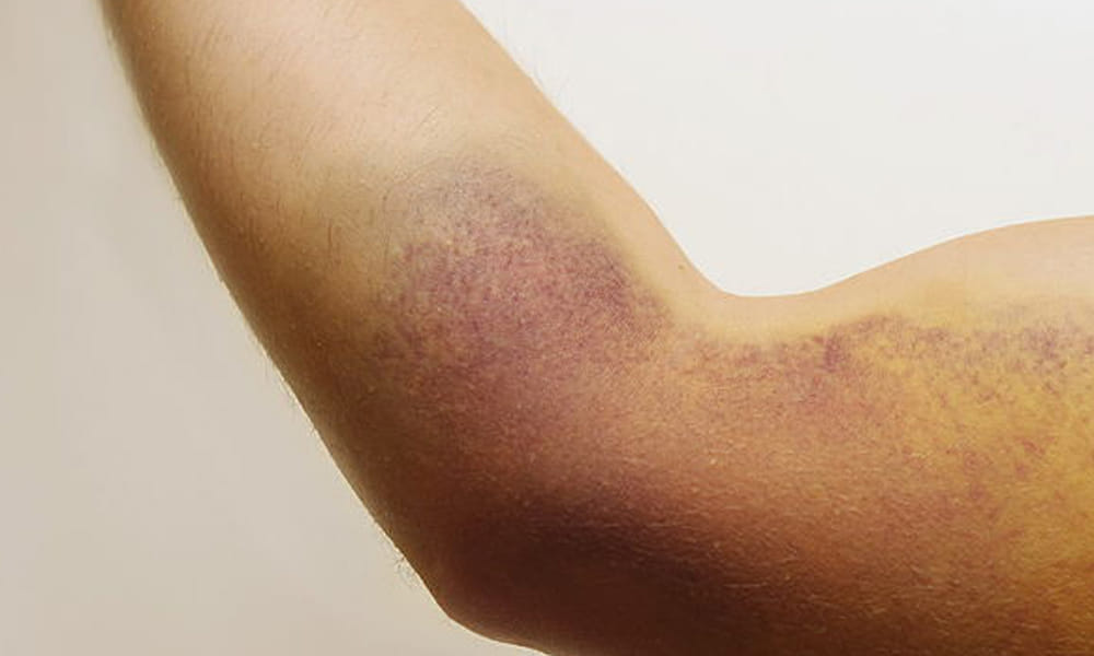 symptoms of cancer you must detect timely