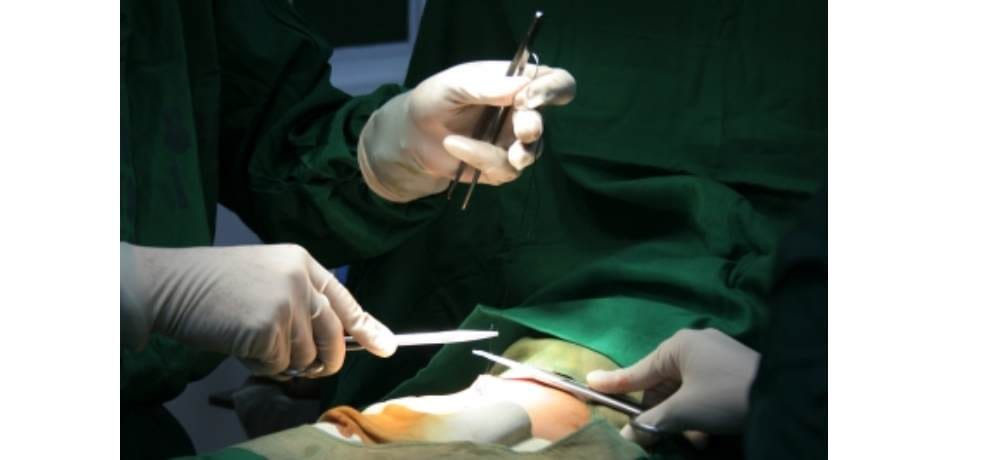 scissor found in stomach during operation at pgi chandigarh