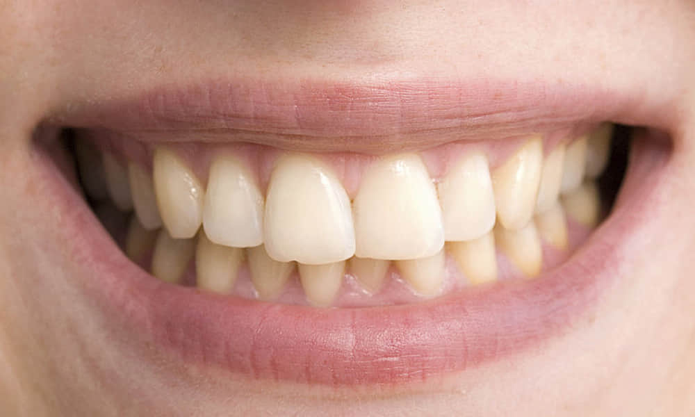 प्रतीकात्मक