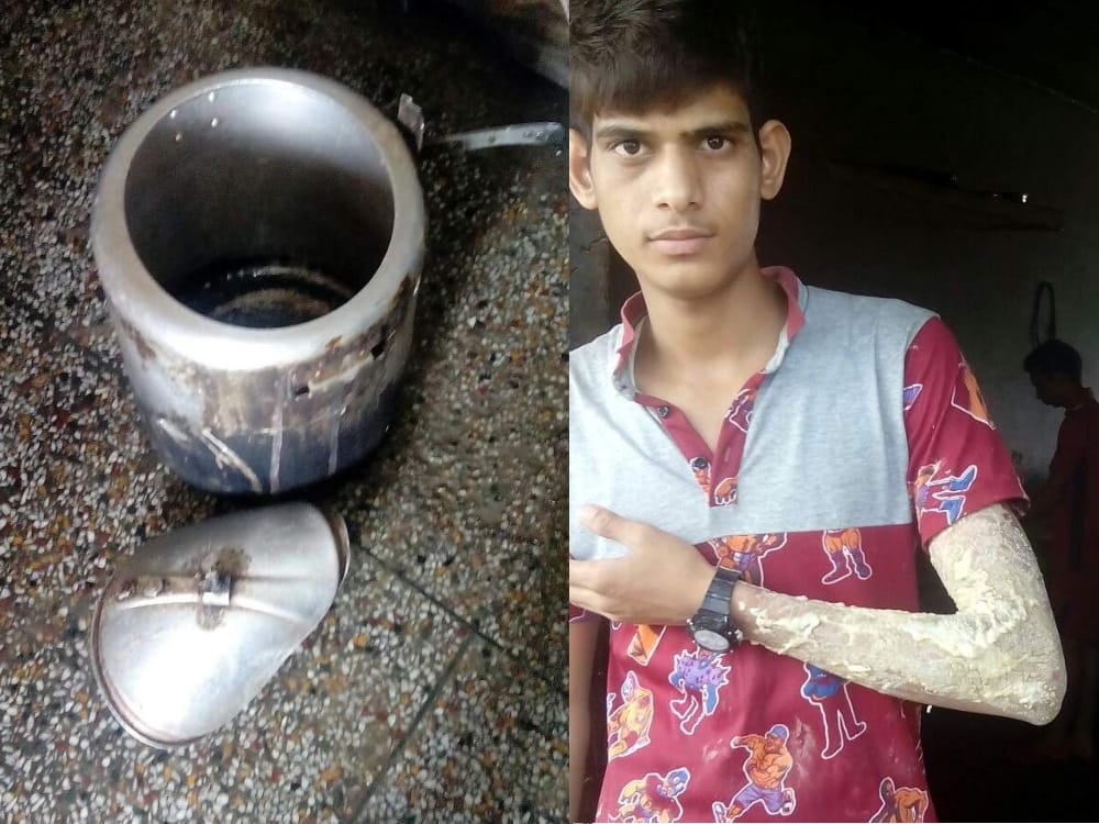 cooker blast in tiuni school