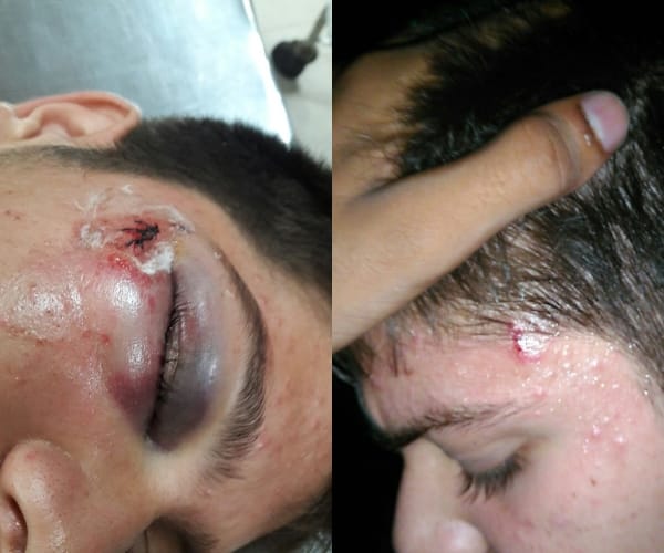  A student get beaten by his friends.